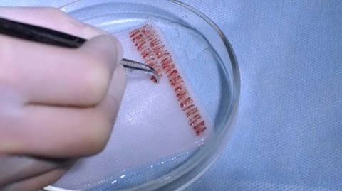 Graft Preparation